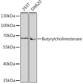 Butyrylcholinesterase Rabbit Polyclonal Antibody