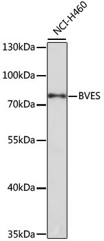BVES Rabbit Polyclonal Antibody