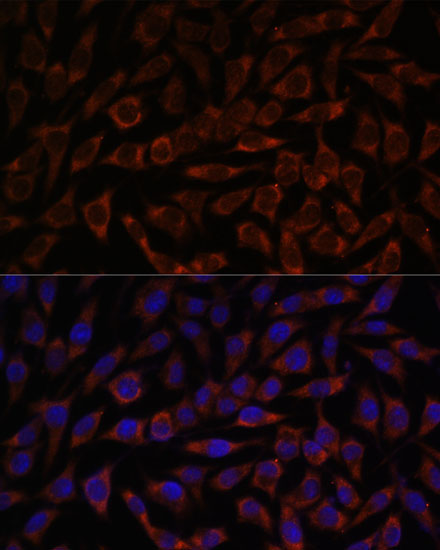 BZW2 Rabbit Polyclonal Antibody - Image 2