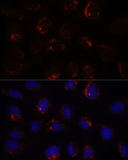 BZW2 Rabbit Polyclonal Antibody - Image 3