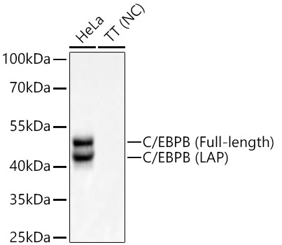 C/EBPB Rabbit Monoclonal Antibody