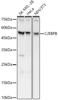 C/EBPB Rabbit Polyclonal Antibody
