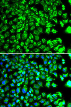 C10orf32 Rabbit Polyclonal Antibody - Image 2