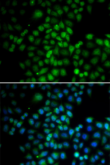C11orf30 Rabbit Polyclonal Antibody