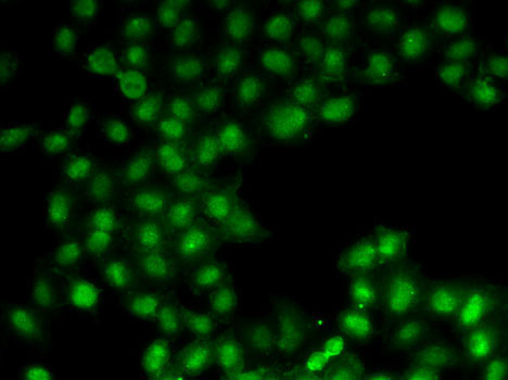 C11orf30 Rabbit Polyclonal Antibody - Image 2