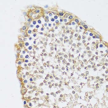 C12orf10 Rabbit Polyclonal Antibody