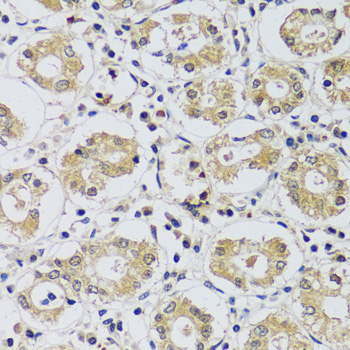 C12orf10 Rabbit Polyclonal Antibody - Image 2