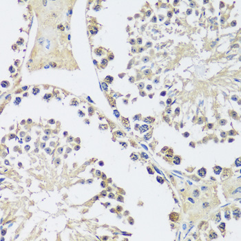 C12orf10 Rabbit Polyclonal Antibody - Image 3