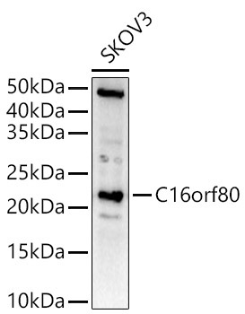 C16orf80 Rabbit Polyclonal Antibody - Image 3