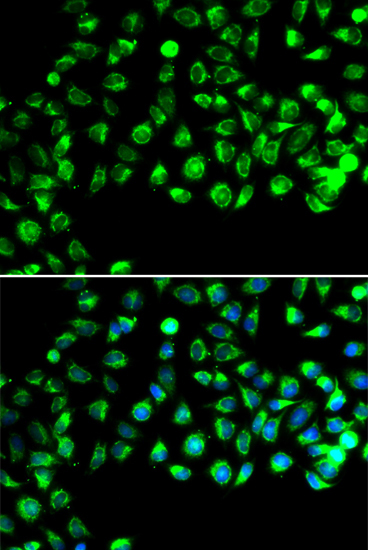C16orf80 Rabbit Polyclonal Antibody - Image 4