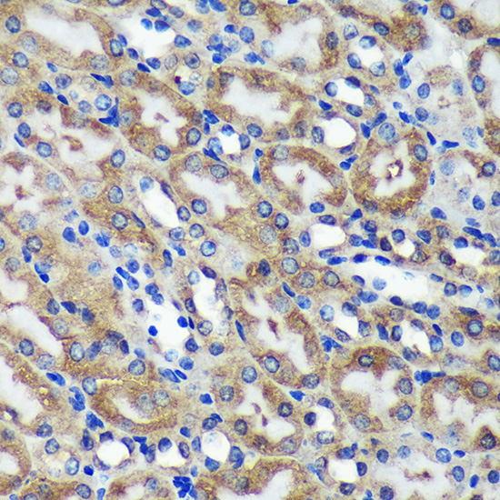 C18orf8 Rabbit Polyclonal Antibody - Image 2