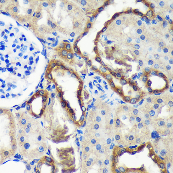 C18orf8 Rabbit Polyclonal Antibody - Image 3
