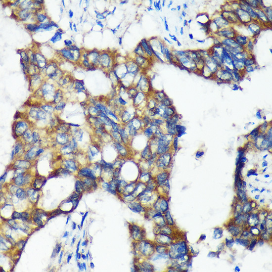 C18orf8 Rabbit Polyclonal Antibody - Image 4