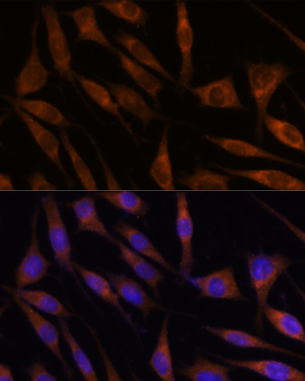 C18orf8 Rabbit Polyclonal Antibody - Image 5