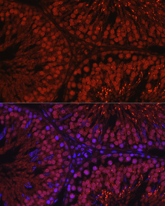 C1orf146 Rabbit Polyclonal Antibody - Image 2