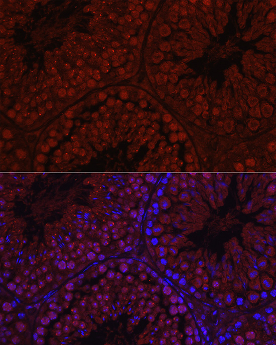 C1orf146 Rabbit Polyclonal Antibody - Image 3