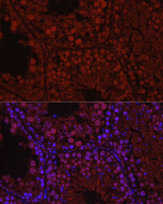 C1orf146 Rabbit Polyclonal Antibody - Image 4