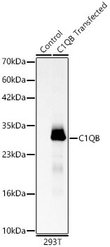 C1QB Rabbit Polyclonal Antibody