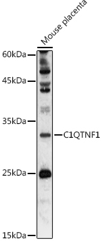 C1QTNF1 Rabbit Polyclonal Antibody