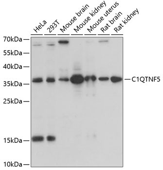 C1QTNF5 Rabbit Polyclonal Antibody
