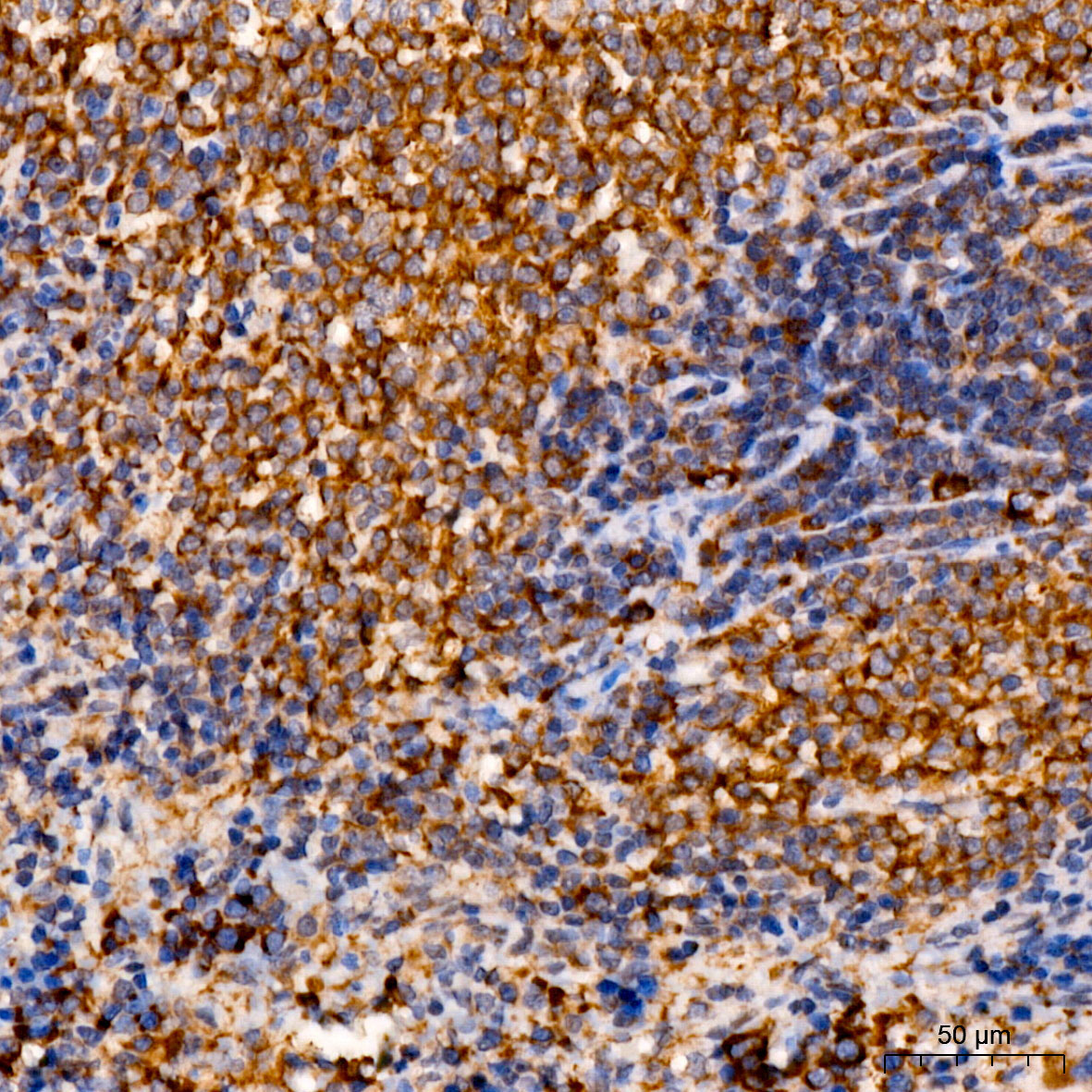C1R Rabbit Polyclonal Antibody