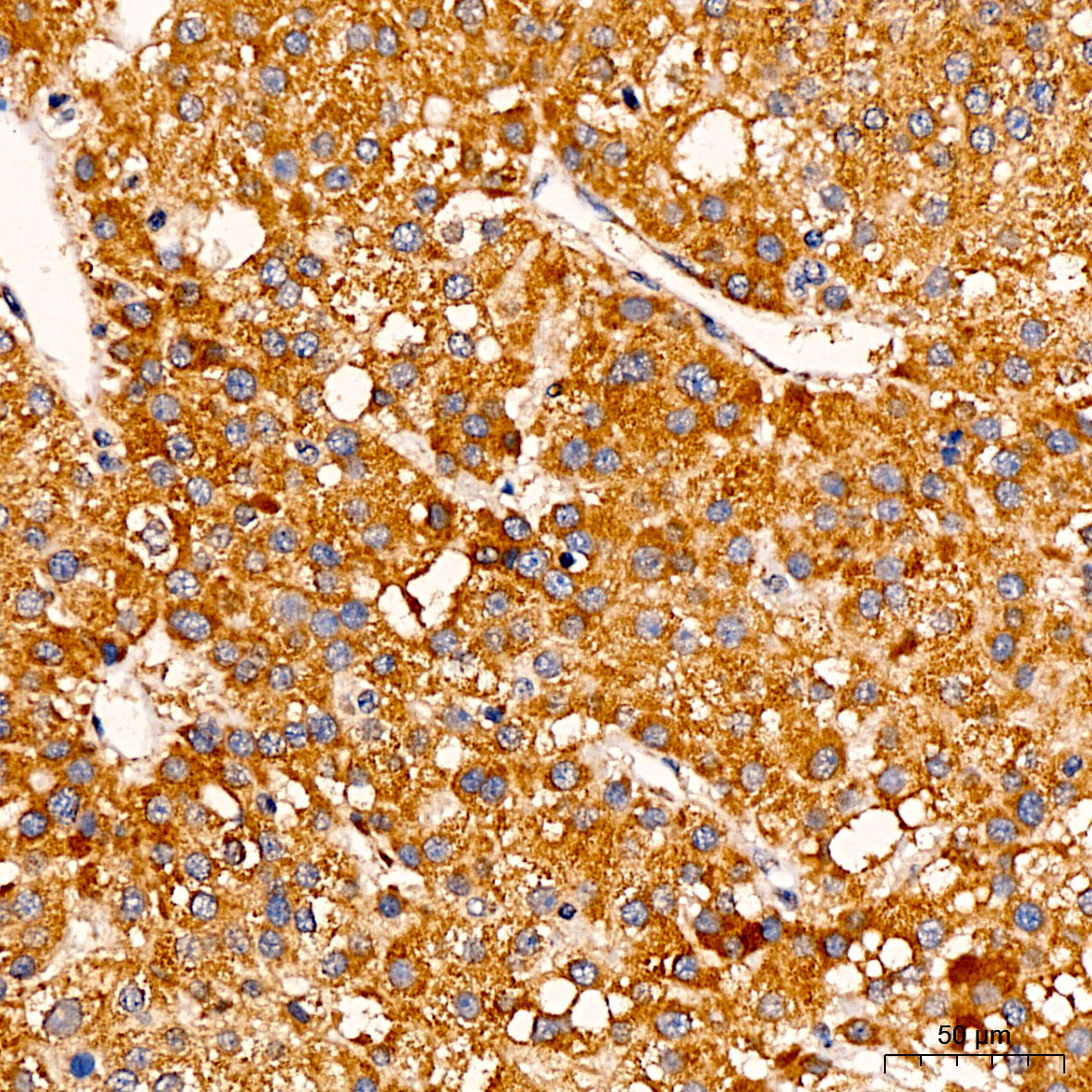 C1R Rabbit Polyclonal Antibody - Image 2