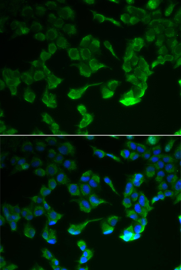 C1R Rabbit Polyclonal Antibody