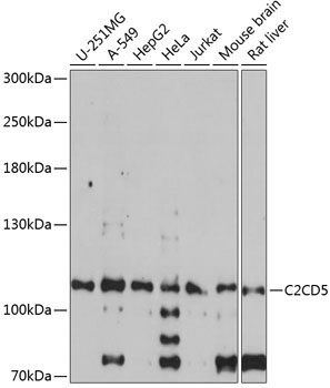 C2CD5 Rabbit Polyclonal Antibody
