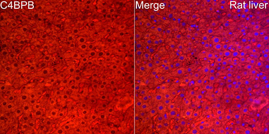 C4BPB Rabbit Polyclonal Antibody - Image 2