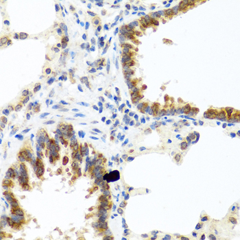 C8orf4 Rabbit Polyclonal Antibody - Image 2