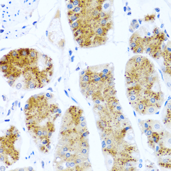 C8orf4 Rabbit Polyclonal Antibody - Image 3