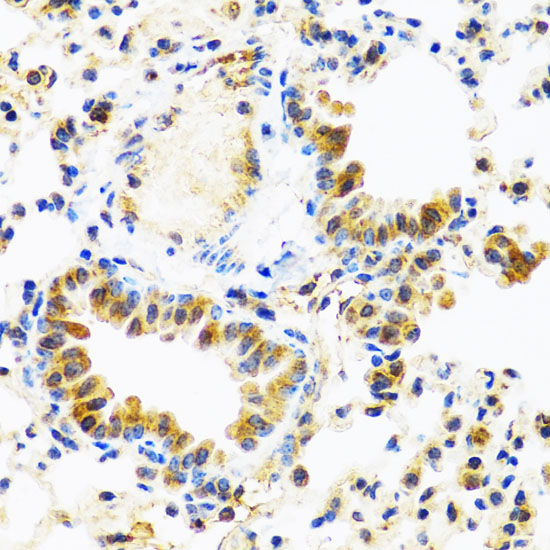 C8orf4 Rabbit Polyclonal Antibody - Image 4