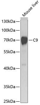 C9 Rabbit Polyclonal Antibody