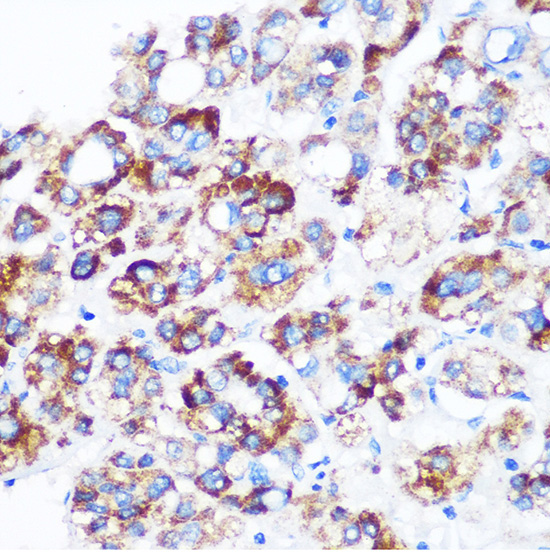 C9orf114 Rabbit Polyclonal Antibody - Image 2