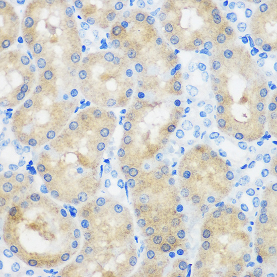 C9orf114 Rabbit Polyclonal Antibody - Image 3