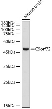 C9orf72 Rabbit Polyclonal Antibody