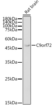C9orf72 Rabbit Polyclonal Antibody - Image 2