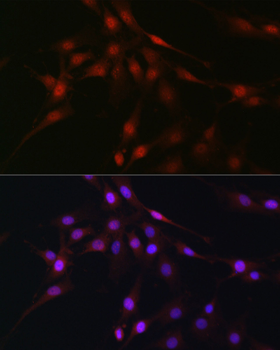 C9orf72 Rabbit Polyclonal Antibody - Image 3