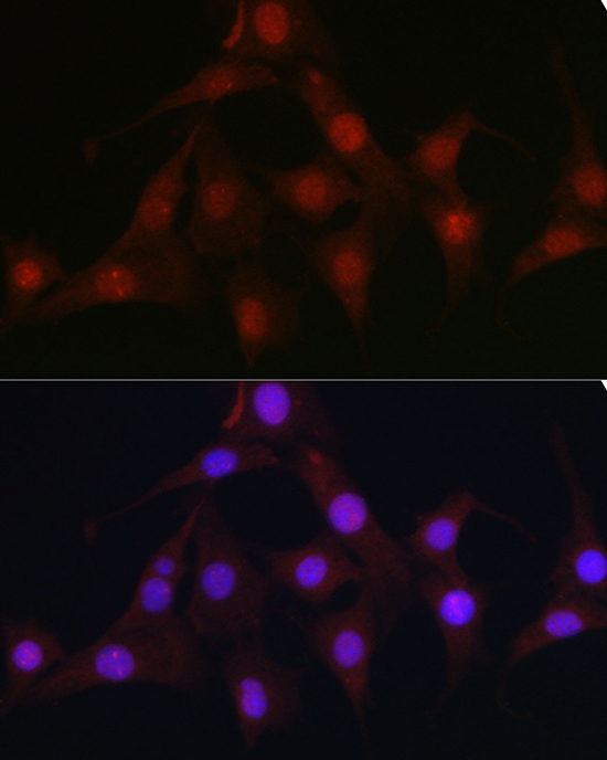 C9orf72 Rabbit Polyclonal Antibody - Image 4