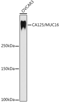 CA125 / MUC16 Rabbit Monoclonal Antibody
