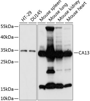 CA13 Rabbit Polyclonal Antibody