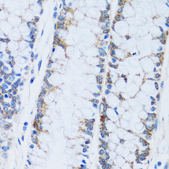 CA13 Rabbit Polyclonal Antibody - Image 2