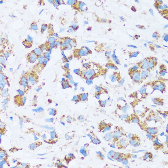 CA13 Rabbit Polyclonal Antibody - Image 3
