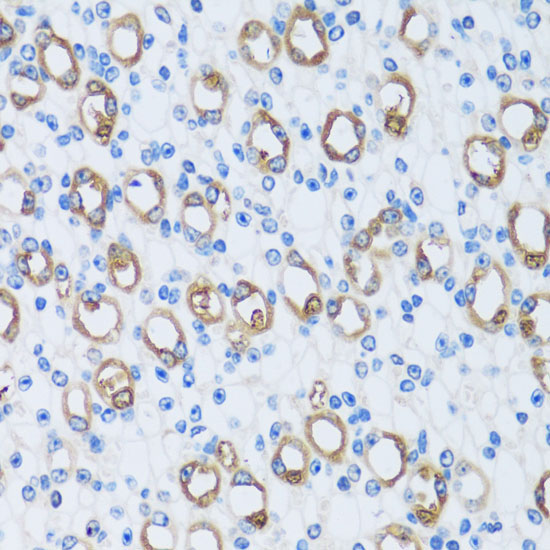 CA13 Rabbit Polyclonal Antibody - Image 4