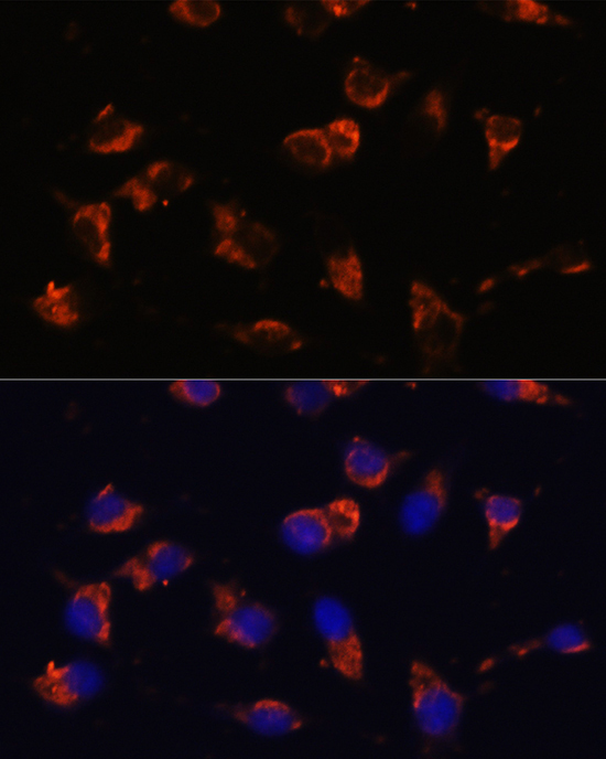 CA19-9 Mouse Monoclonal Antibody