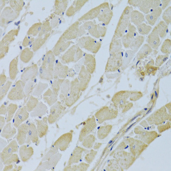 CA3 Rabbit Polyclonal Antibody - Image 4