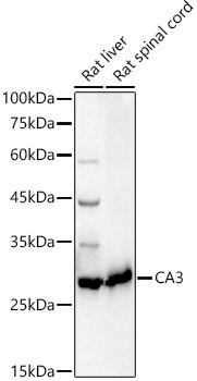 CA3 Rabbit Polyclonal Antibody - Image 2