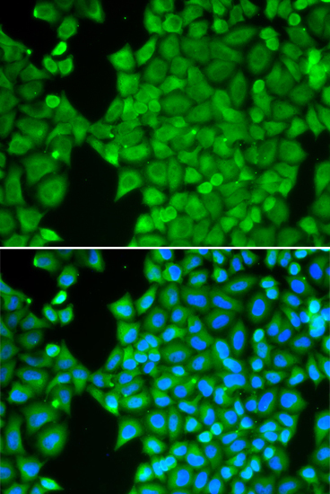 CA3 Rabbit Polyclonal Antibody - Image 3