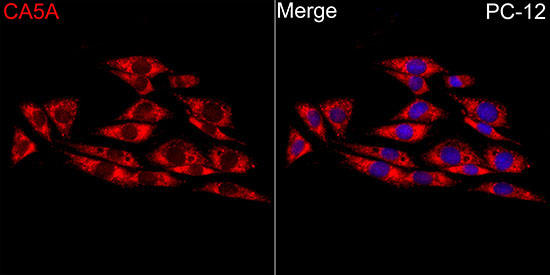 CA5A Rabbit Polyclonal Antibody - Image 3