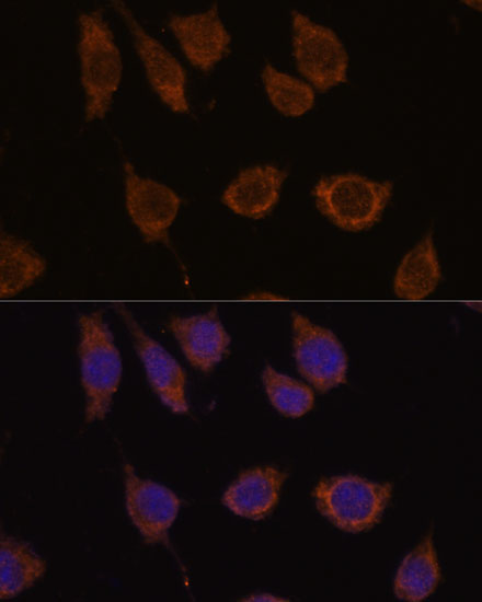 CA5B Rabbit Polyclonal Antibody - Image 2